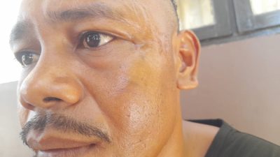 Dikeroyok di Depan Polsek Amanuban Selatan, Polisi Diduga Diam