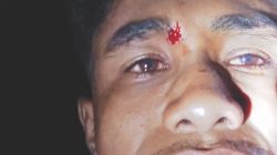 Dijebak Lalu Dikeroyok! Ifan Fallo Diserang Brutal di Fatukopa